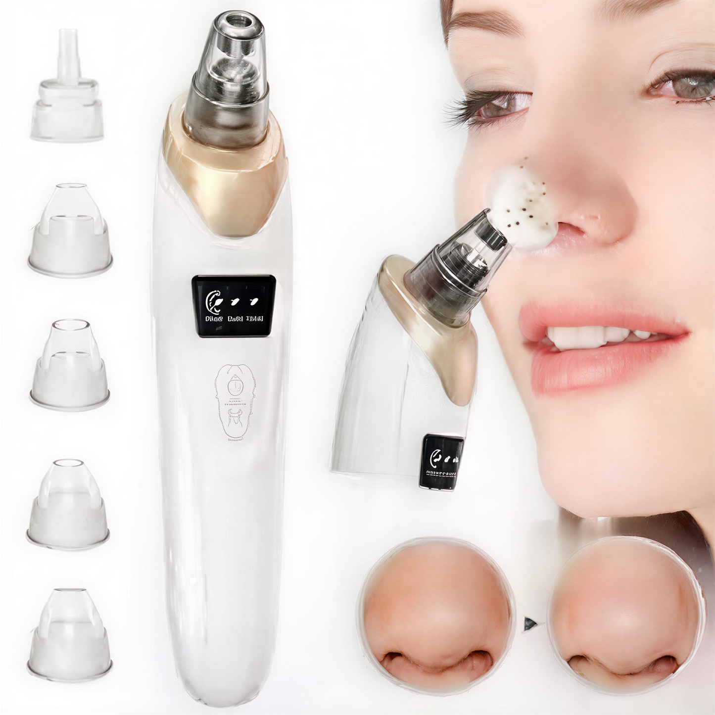 Blackhead Vacuum Cleaner