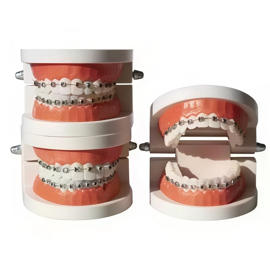Dental Braces Decoration Kit