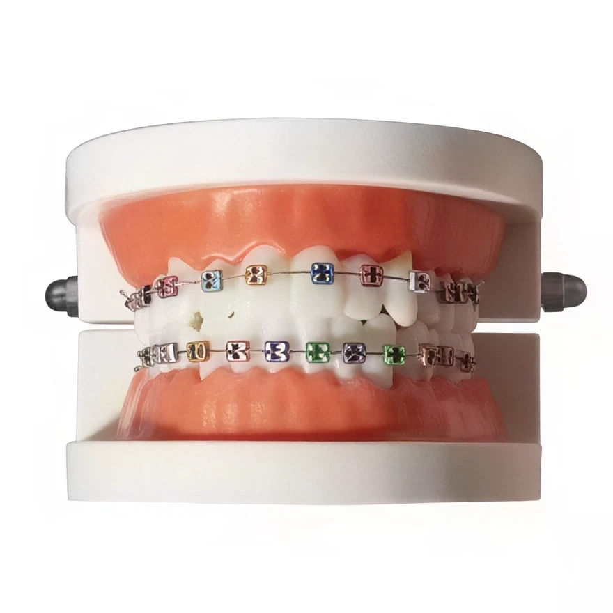 Dental Braces Decoration Kit