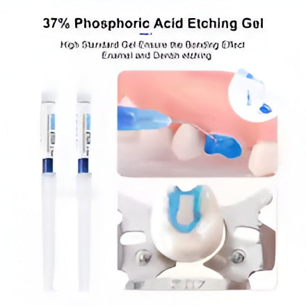 Diamond Smile Bonding Kit